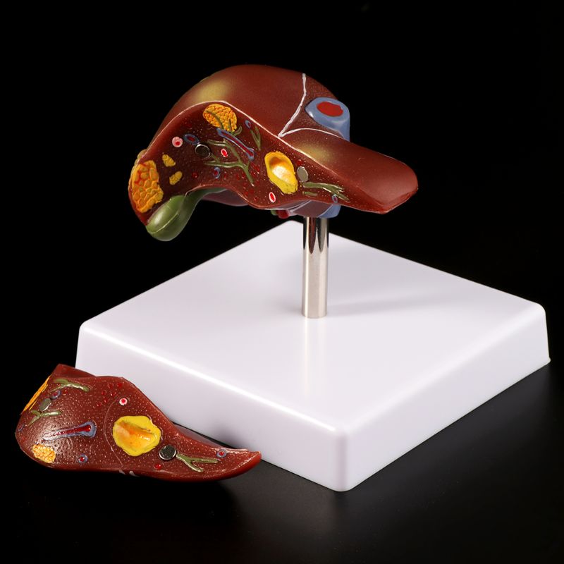 Medical Lab Design - Modèle d'anatomie pathologique du fœtus humain,