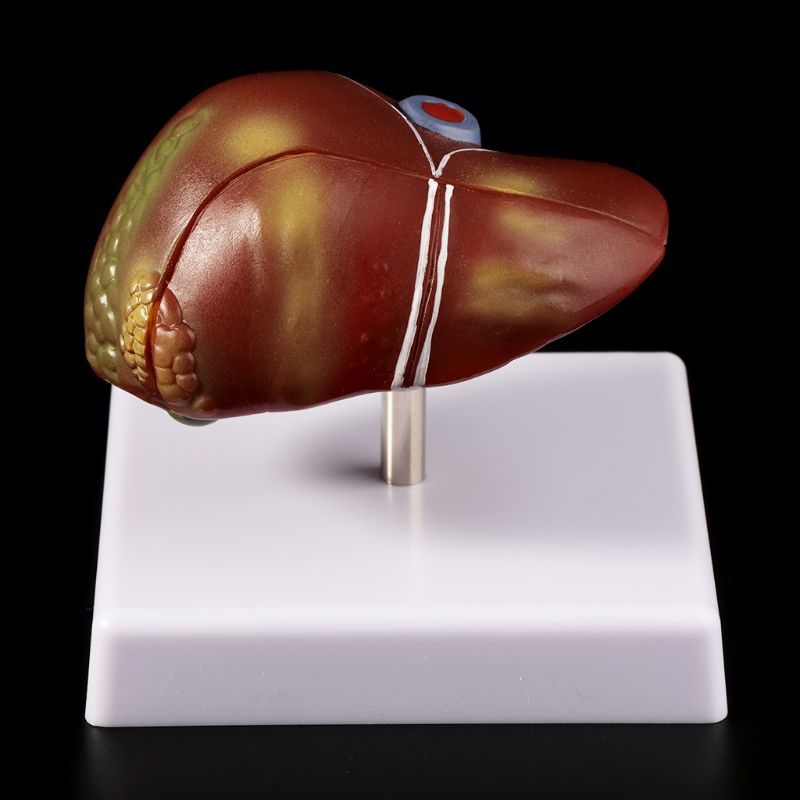 Modèle d'anatomie pathologique - Medical Lab Design avis et prix
