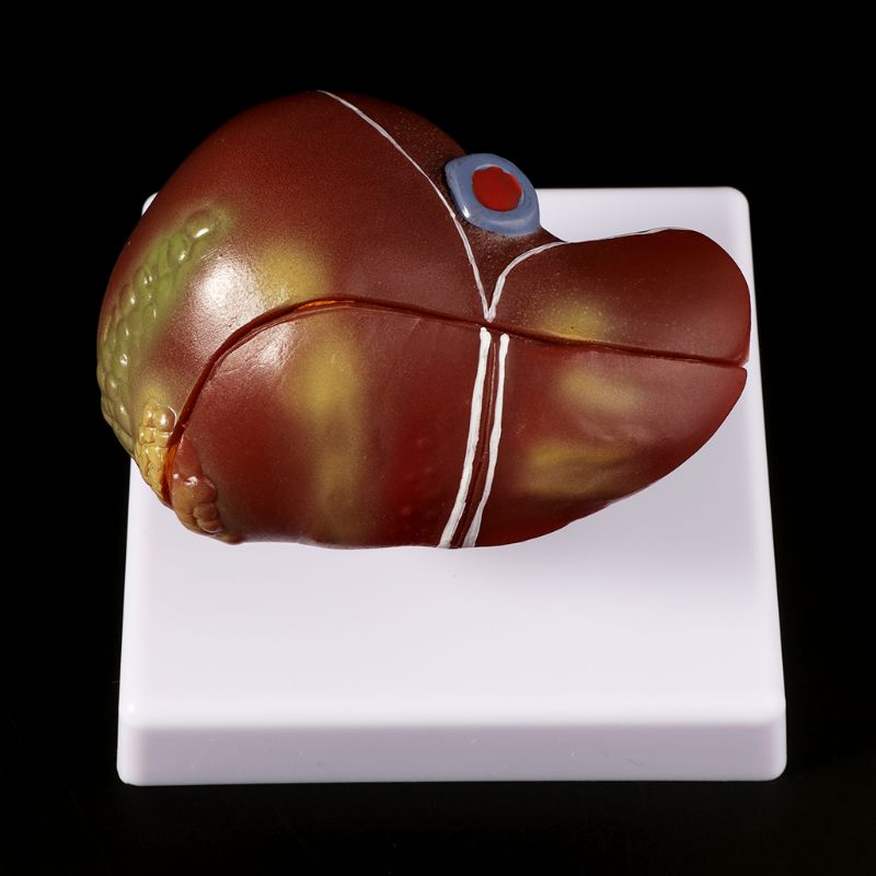 Modèle d'anatomie pathologique - Medical Lab Design avis et prix